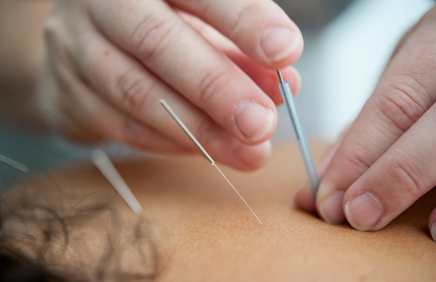 traditional Chinese medicine