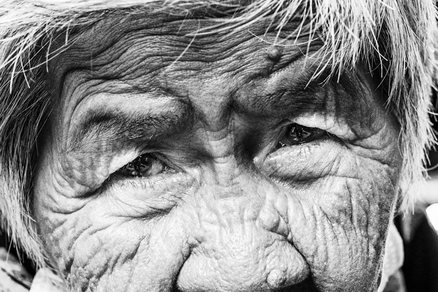 Photo biological aging
